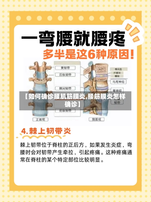 【如何确诊腰肌筋膜炎,腰筋膜炎怎样确诊】-第2张图片