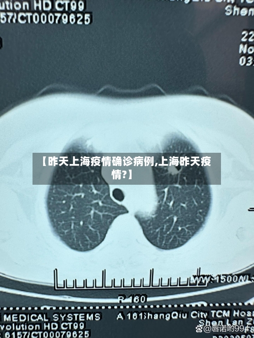 【昨天上海疫情确诊病例,上海昨天疫情?】