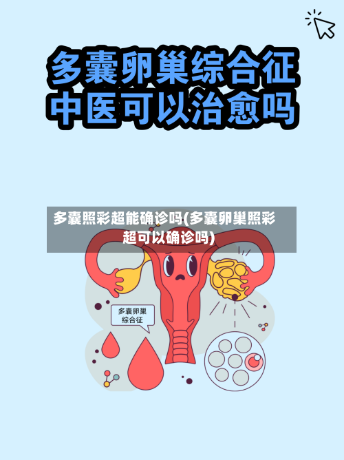 多囊照彩超能确诊吗(多囊卵巢照彩超可以确诊吗)-第2张图片