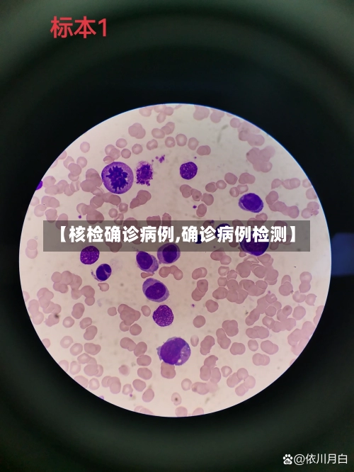 【核检确诊病例,确诊病例检测】-第2张图片