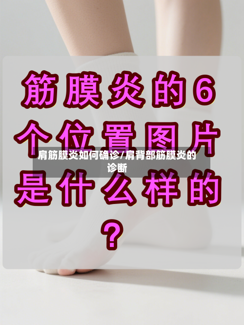 肩筋膜炎如何确诊/肩背部筋膜炎的诊断