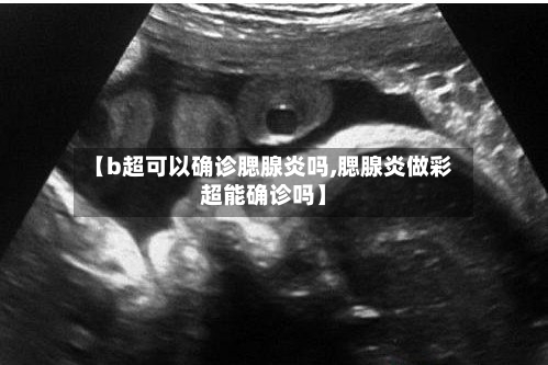 【b超可以确诊腮腺炎吗,腮腺炎做彩超能确诊吗】-第2张图片