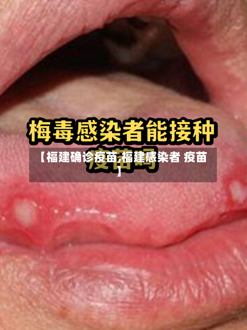 【福建确诊疫苗,福建感染者 疫苗】