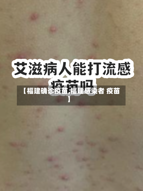 【福建确诊疫苗,福建感染者 疫苗】-第2张图片