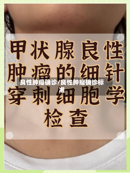良性肿瘤确诊/良性肿瘤确诊标准