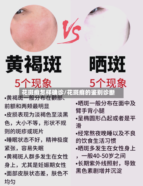 花斑癣怎样确诊/花斑癣的鉴别诊断-第3张图片