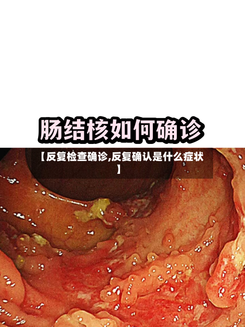 【反复检查确诊,反复确认是什么症状】