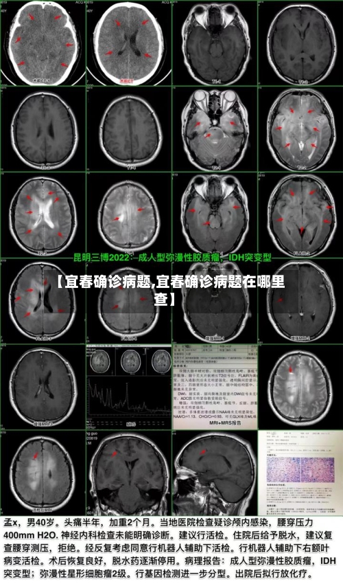 【宜春确诊病题,宜春确诊病题在哪里查】-第3张图片
