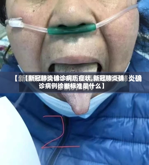 【新冠肺炎确诊病历症状,新冠肺炎确诊病例诊断标准是什么】
