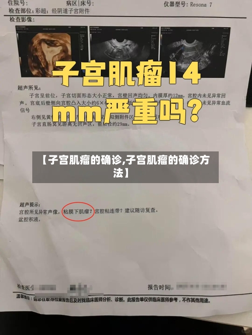 【子宫肌瘤的确诊,子宫肌瘤的确诊方法】-第1张图片