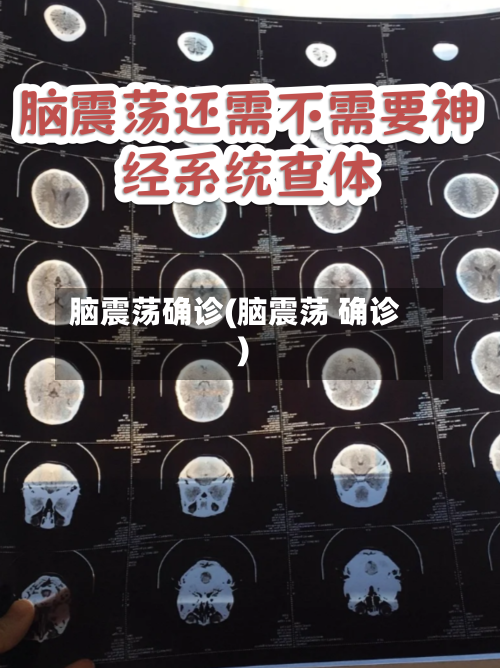 脑震荡确诊(脑震荡 确诊)