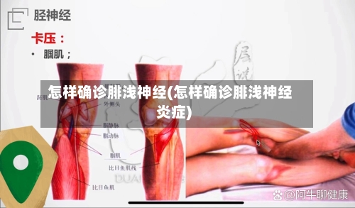 怎样确诊腓浅神经(怎样确诊腓浅神经炎症)