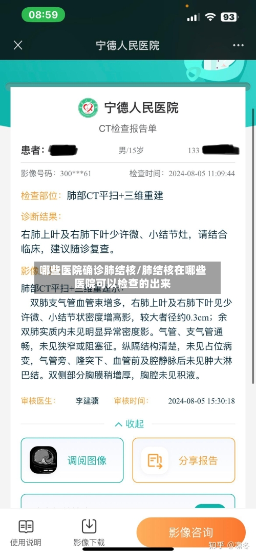 哪些医院确诊肺结核/肺结核在哪些医院可以检查的出来-第3张图片