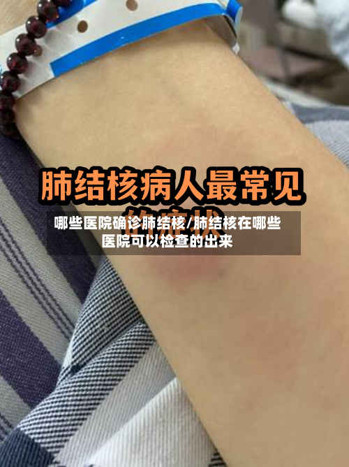 哪些医院确诊肺结核/肺结核在哪些医院可以检查的出来-第2张图片