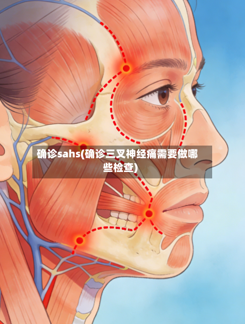 确诊sahs(确诊三叉神经痛需要做哪些检查)
