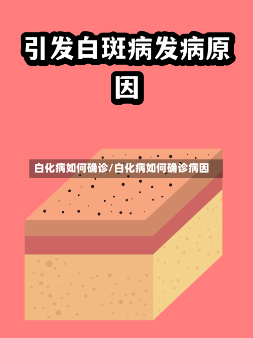白化病如何确诊/白化病如何确诊病因