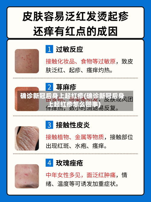 确诊新冠后身上起红疹(确诊新冠后身上起红疹怎么回事)-第2张图片