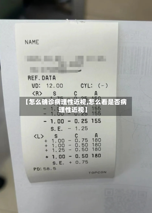 【怎么确诊病理性近视,怎么看是否病理性近视】-第1张图片