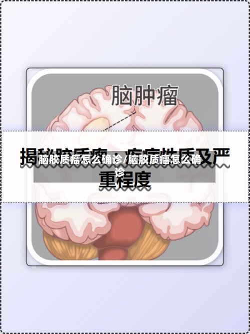 脑胶质瘤怎么确诊/脑胶质瘤怎么确诊-第3张图片