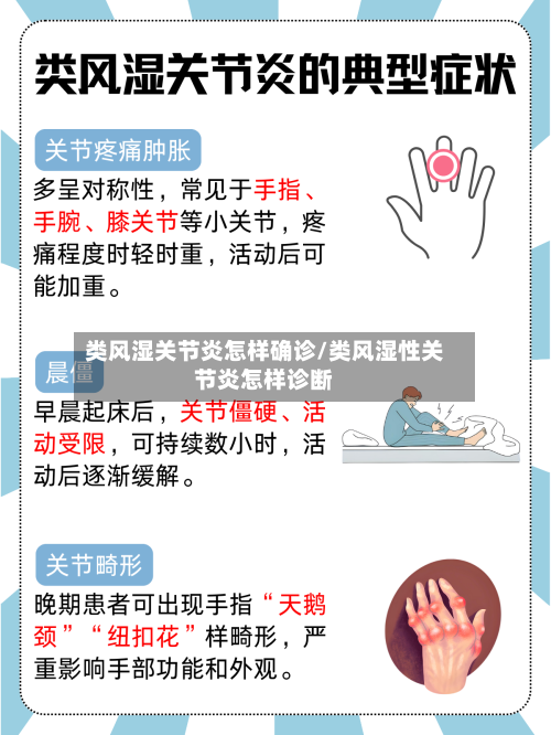 类风湿关节炎怎样确诊/类风湿性关节炎怎样诊断-第1张图片