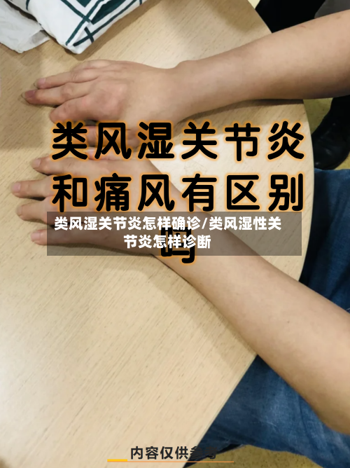 类风湿关节炎怎样确诊/类风湿性关节炎怎样诊断-第2张图片