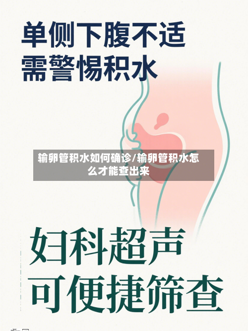 输卵管积水如何确诊/输卵管积水怎么才能查出来-第2张图片