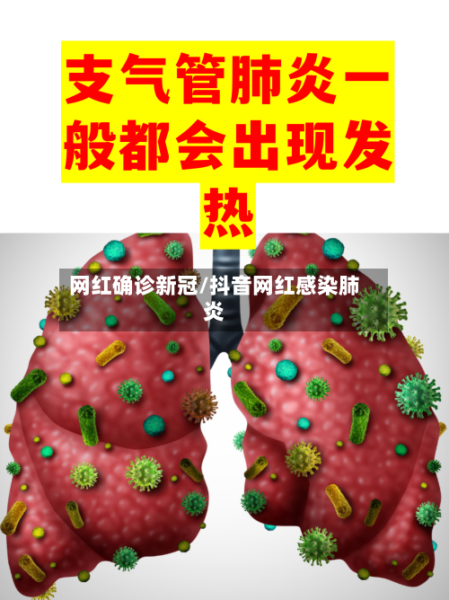 网红确诊新冠/抖音网红感染肺炎