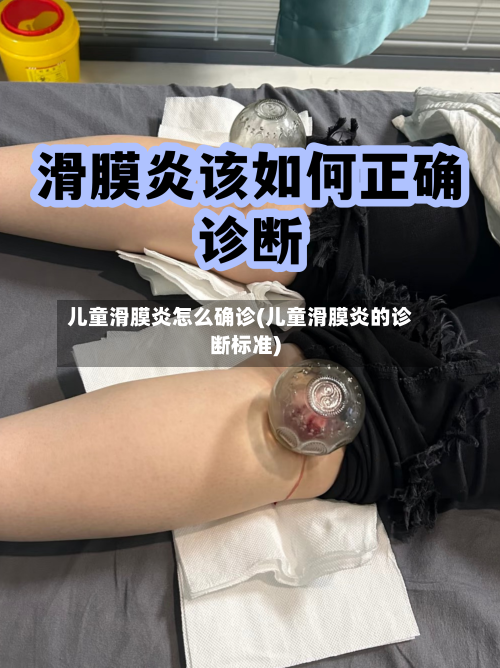 儿童滑膜炎怎么确诊(儿童滑膜炎的诊断标准)