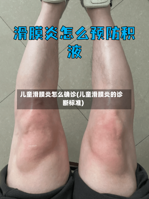 儿童滑膜炎怎么确诊(儿童滑膜炎的诊断标准)-第3张图片