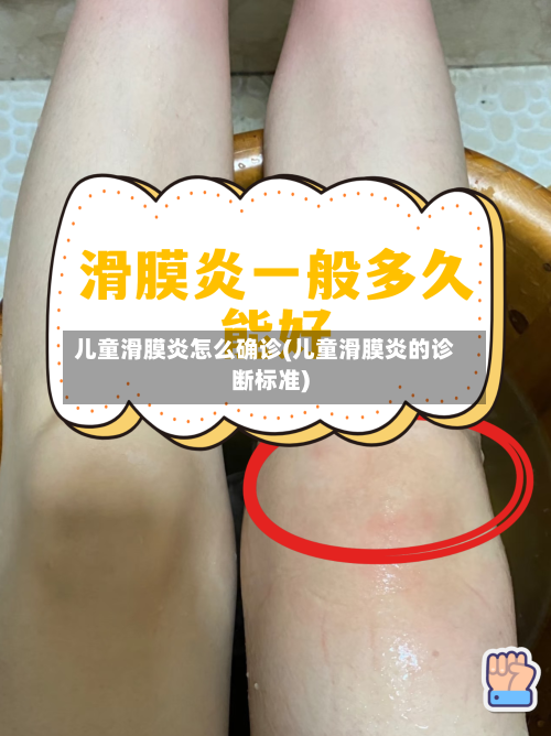 儿童滑膜炎怎么确诊(儿童滑膜炎的诊断标准)-第2张图片