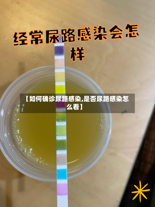 【如何确诊尿路感染,是否尿路感染怎么看】-第2张图片