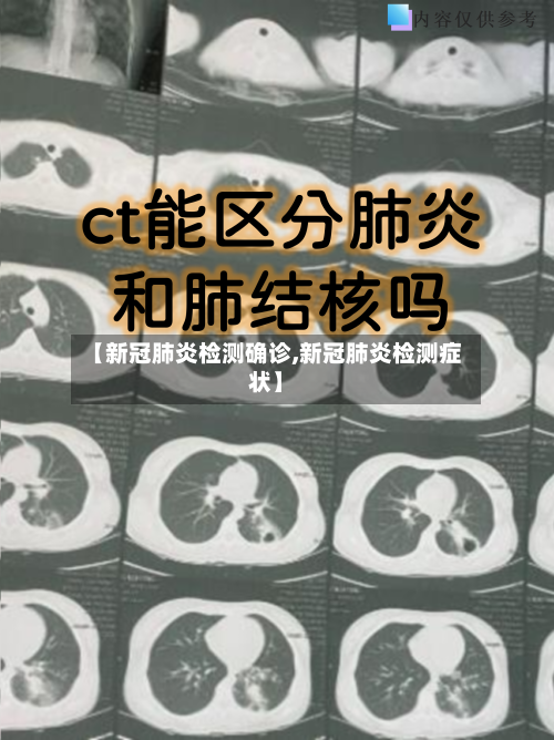 【新冠肺炎检测确诊,新冠肺炎检测症状】-第2张图片