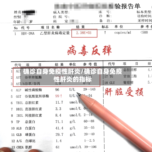 确诊自身免疫性肝炎/确诊自身免疫性肝炎的指标-第2张图片