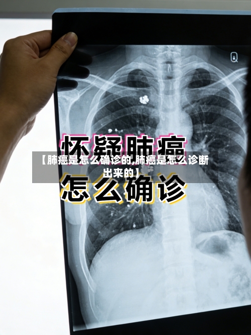 【肺癌是怎么确诊的,肺癌是怎么诊断出来的】