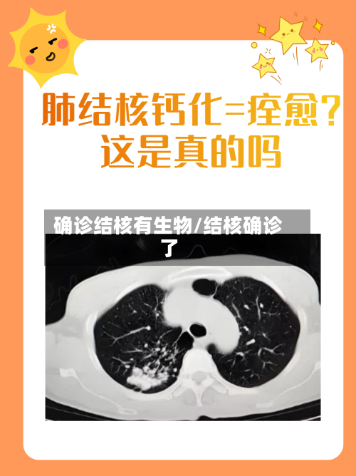 确诊结核有生物/结核确诊了-第2张图片