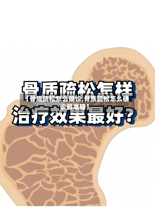 【骨质疏松怎么确诊,骨质疏松怎么确诊最准确】-第1张图片