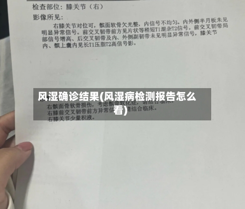 风湿确诊结果(风湿病检测报告怎么看)-第3张图片