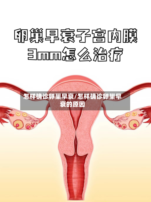 怎样确诊卵巢早衰/怎样确诊卵巢早衰的原因-第2张图片