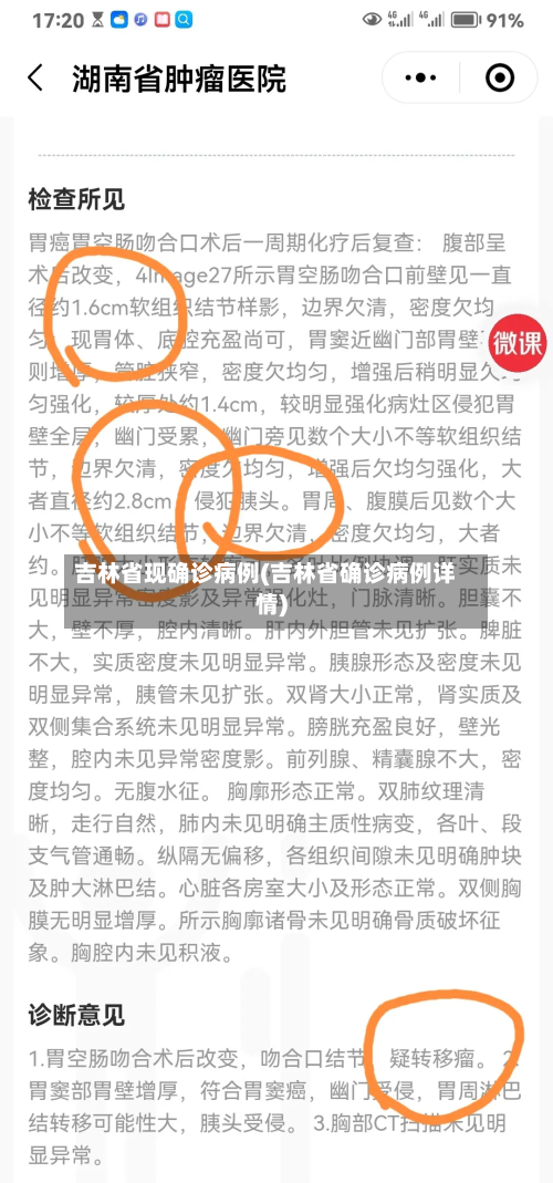 吉林省现确诊病例(吉林省确诊病例详情)