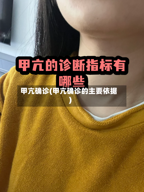 甲亢确诊(甲亢确诊的主要依据)-第2张图片