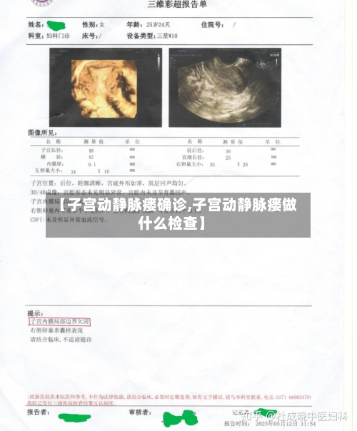 【子宫动静脉瘘确诊,子宫动静脉瘘做什么检查】