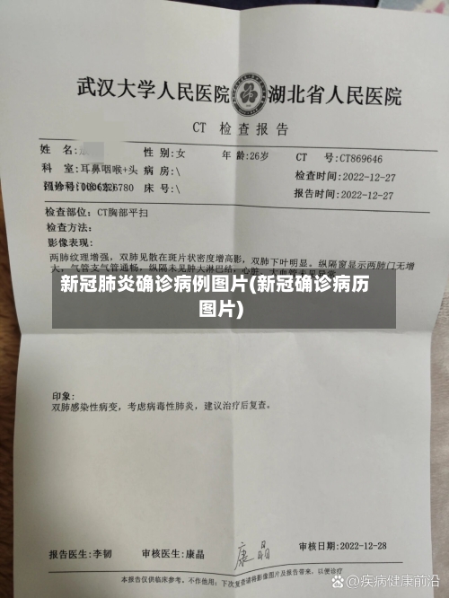 新冠肺炎确诊病例图片(新冠确诊病历图片)