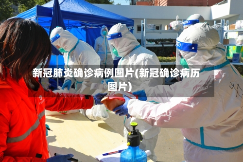 新冠肺炎确诊病例图片(新冠确诊病历图片)-第3张图片