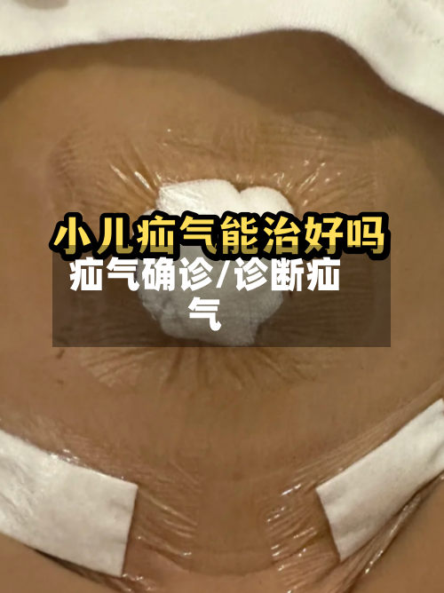 疝气确诊/诊断疝气