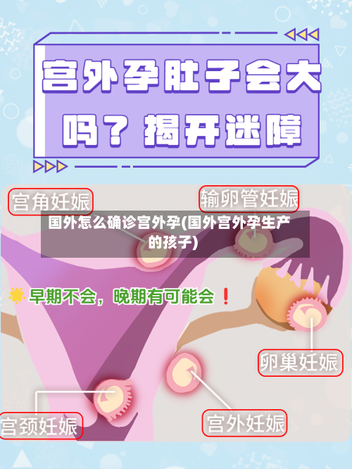 国外怎么确诊宫外孕(国外宫外孕生产的孩子)-第2张图片