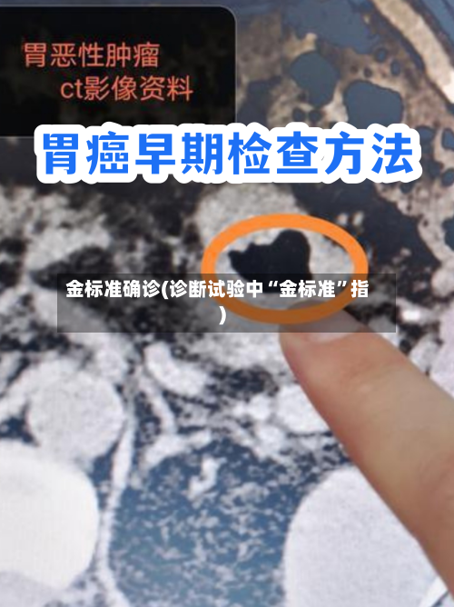 金标准确诊(诊断试验中“金标准”指)-第2张图片