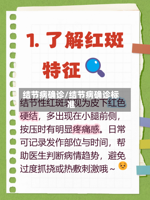 结节病确诊/结节病确诊标准