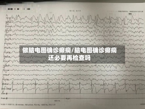 做脑电图确诊癫痫/脑电图确诊癫痫还必要再检查吗