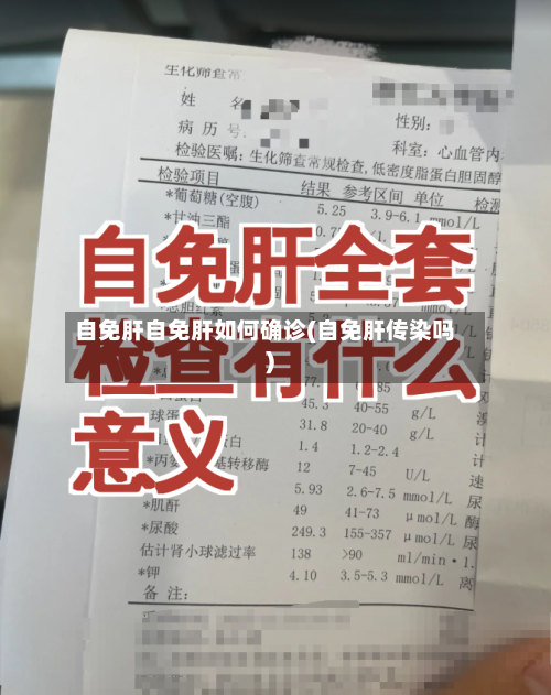 自免肝自免肝如何确诊(自免肝传染吗)