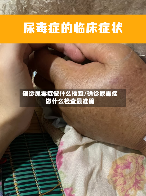 确诊尿毒症做什么检查/确诊尿毒症做什么检查最准确-第2张图片